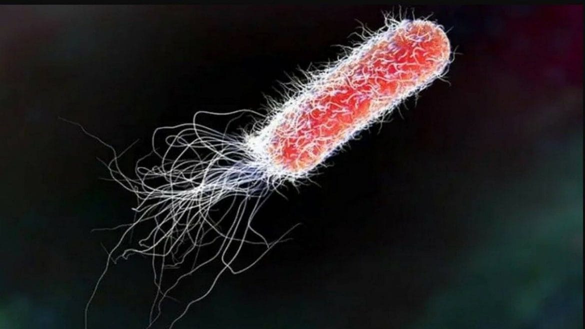 La Bacteria Escherichia coli es una de las posibles causantes de la gastroenteritis